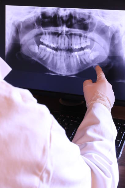Best Emergency Root Canal Treatment in Mmaduke, AR